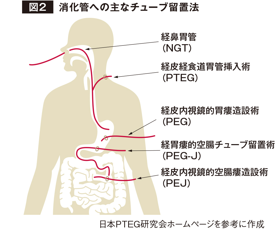 58_0113_図2.jpg